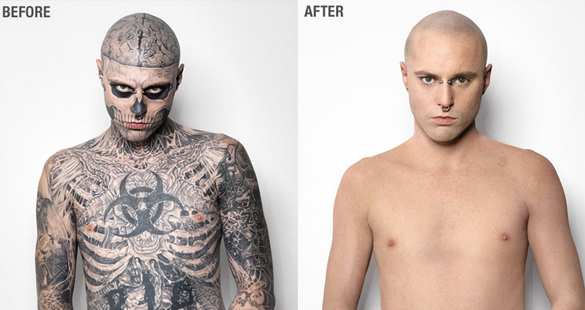 Zombie Boy